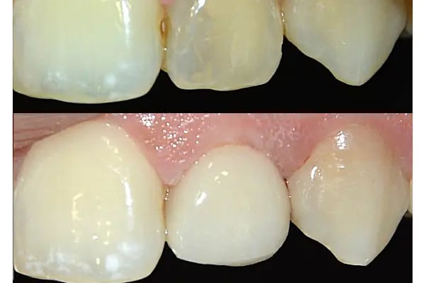 ARTDENT KLİNİK AĞIZ VE DİŞ SAĞLIĞI POLİKLİNİĞİ - Resim 19