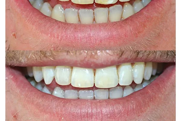 ARTDENT KLİNİK AĞIZ VE DİŞ SAĞLIĞI POLİKLİNİĞİ - Resim 16