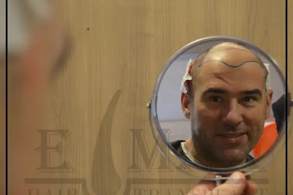 Emax hair - Resim 16