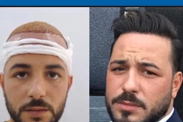 MEDAR Sakarya Saç Ekimi MEDARHAIR - Resim 17