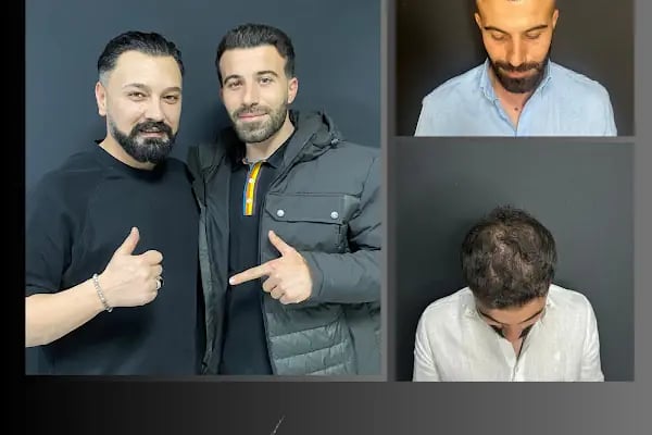 Ömer Uğur Saç Ekim - Resim 6