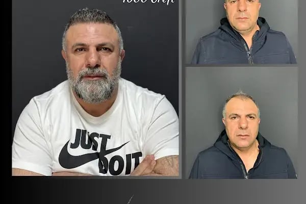 Ömer Uğur Saç Ekim - Resim 16
