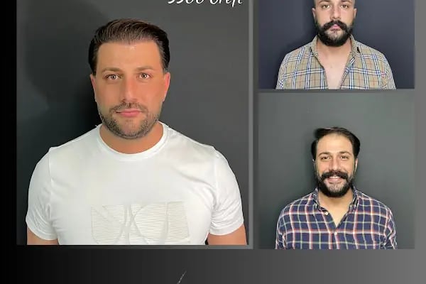 Ömer Uğur Saç Ekim - Resim 18