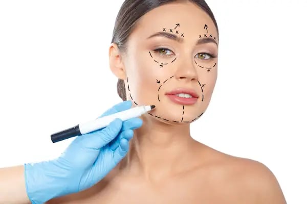 Op.Dr.Evren Ay Koç Rhinoplasty - Burun Estetiği - Resim 14
