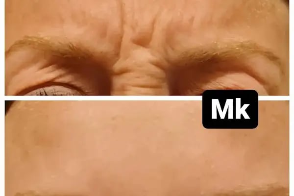 Bodrum Göz - Op. Dr. Meltem Karabacak Koçak - Resim 17