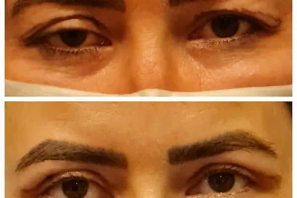 Bodrum Göz - Op. Dr. Meltem Karabacak Koçak - Resim 12