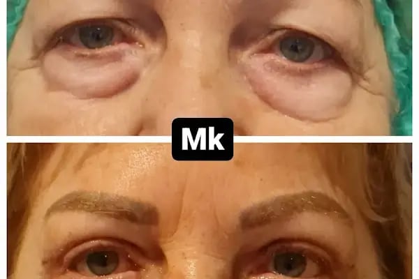 Bodrum Göz - Op. Dr. Meltem Karabacak Koçak - Resim 20