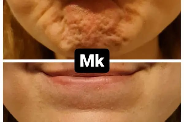 Bodrum Göz - Op. Dr. Meltem Karabacak Koçak - Resim 18