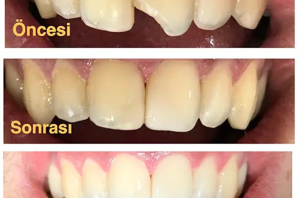 Diş hekimi Ayşe yiğit - Resim 2