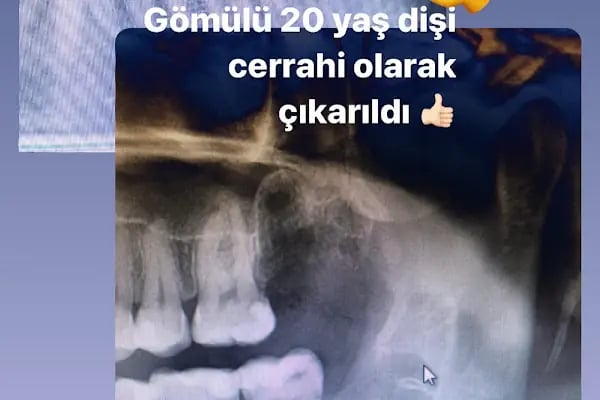 Diş hekimi Ayşe yiğit - Resim 14