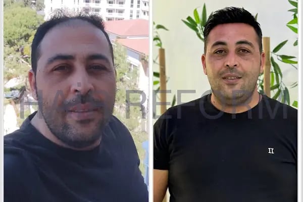 ERAY FESLİGİL PROTEZ SAÇ ANTALYA - Resim 1