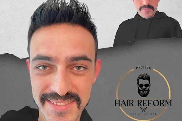 ERAY FESLİGİL PROTEZ SAÇ ANTALYA - Resim 7