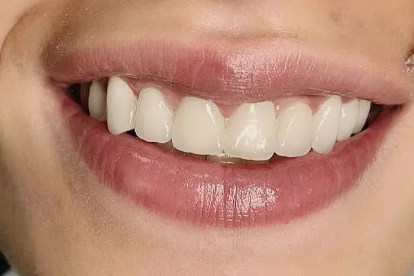 Mef Dental Grup - Malatya Diş Kliniği Şubesi - Resim 17