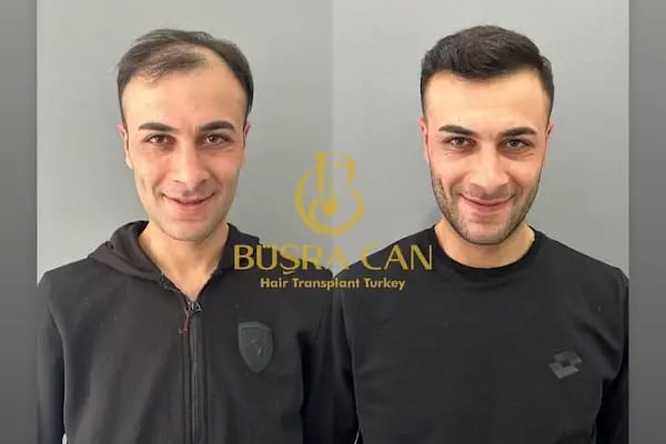 Songül Aktaş Hair &amp; Beauty Center - Resim 16