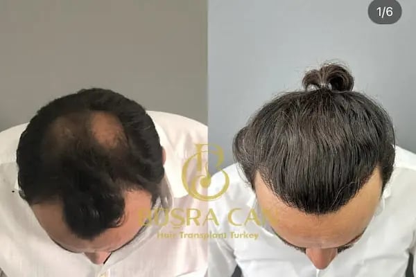 Songül Aktaş Hair &amp; Beauty Center - Resim 13