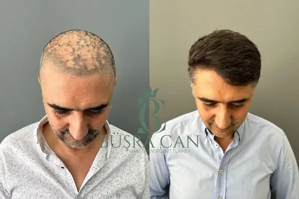 Songül Aktaş Hair &amp; Beauty Center - Resim 2
