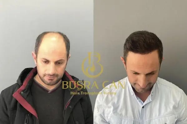 Songül Aktaş Hair &amp; Beauty Center - Resim 5