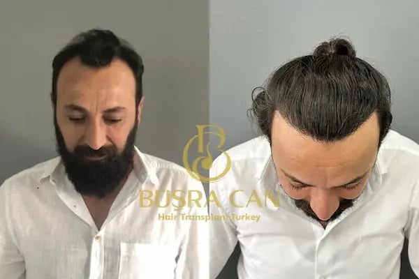 Songül Aktaş Hair &amp; Beauty Center - Resim 8