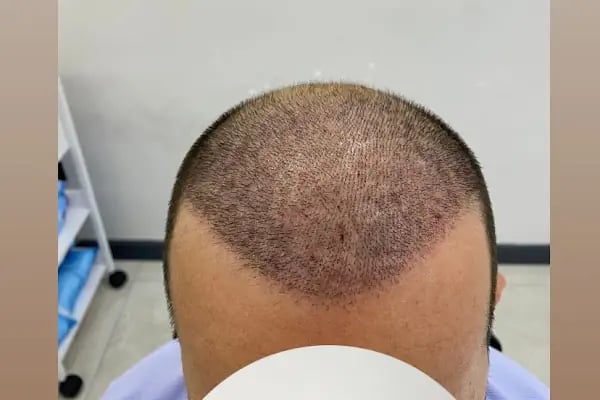 Songül Aktaş Hair &amp; Beauty Center - Resim 19