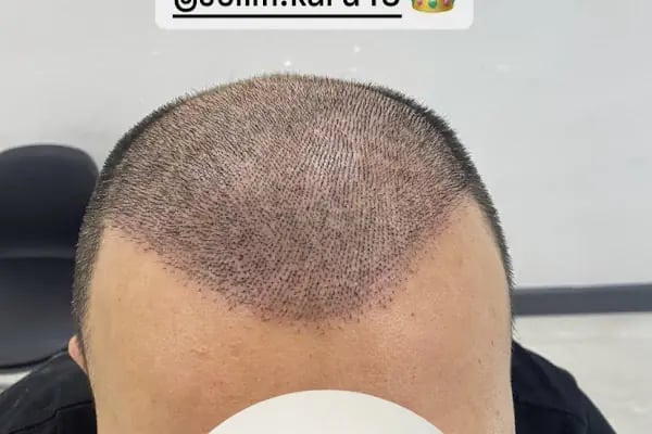 Songül Aktaş Hair &amp; Beauty Center - Resim 11