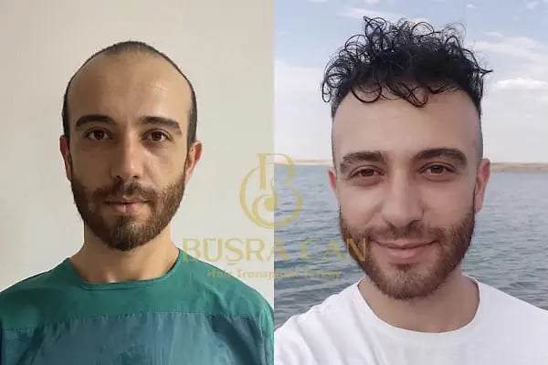 Songül Aktaş Hair &amp; Beauty Center - Resim 4