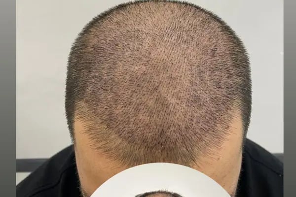 Songül Aktaş Hair &amp; Beauty Center - Resim 20