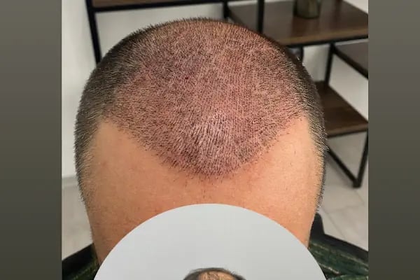 Songül Aktaş Hair &amp; Beauty Center - Resim 7