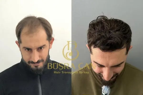 Songül Aktaş Hair &amp; Beauty Center - Resim 10