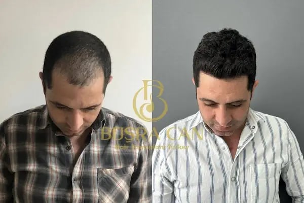 Songül Aktaş Hair &amp; Beauty Center - Resim 6