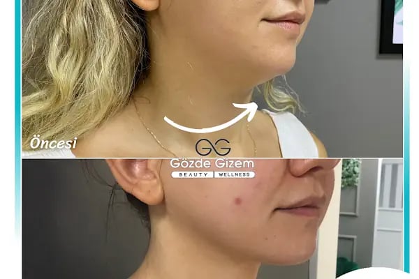 Gözde Gizem Beauty - Resim 10