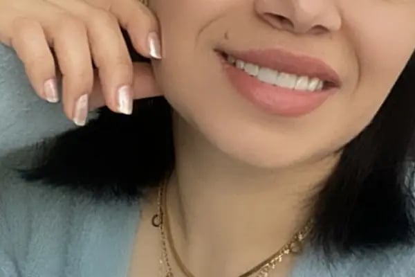 Diş Hekimi Sibel Özen Seyhan Adana Elmas Diş Kliniği - Resim 19