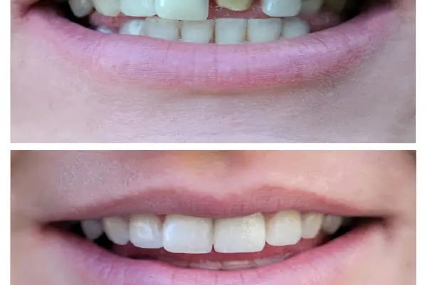Diş Hekimi Sibel Özen Seyhan Adana Elmas Diş Kliniği - Resim 20