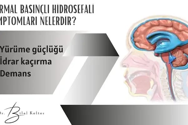 Prof. Dr. Bilal Kelten - Beyin Cerrahı, Bel fıtığı tedavisi, boyun fıtığı tedavisi, Ataşehir, Kadıköy, Maltepe - Resim 13