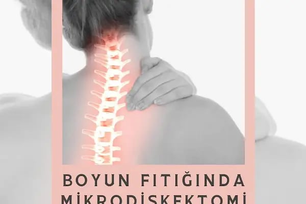 Prof. Dr. Bilal Kelten - Beyin Cerrahı, Bel fıtığı tedavisi, boyun fıtığı tedavisi, Ataşehir, Kadıköy, Maltepe - Resim 15