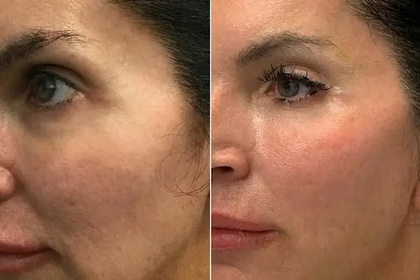 Plastderm - Resim 10