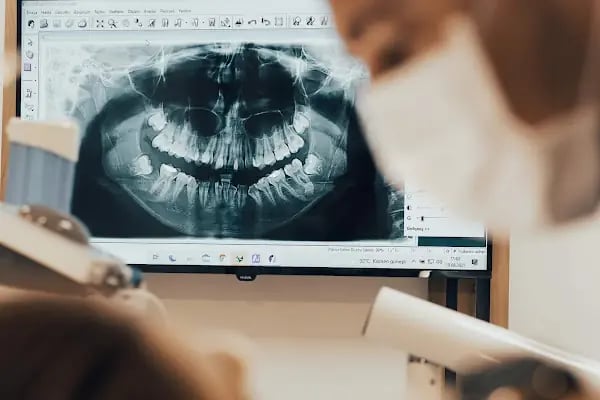 Özel Çukurova Dental Ağız Ve Diş Sağlığı Polikliniği - Resim 16
