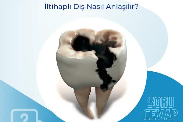 Özel Çukurova Dental Ağız Ve Diş Sağlığı Polikliniği - Resim 17