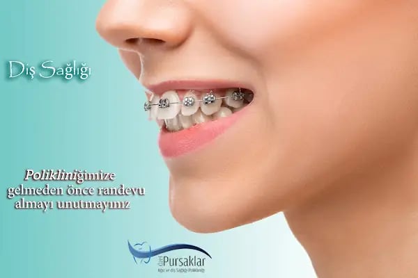 Dr. Yusuf BAL Ankara Sünnet Doktoru &amp; Dt. Elifsu BAL Ankara Diş Hekimi - Resim 12