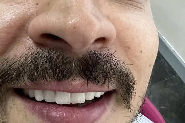 Dr. Yusuf BAL Ankara Sünnet Doktoru &amp; Dt. Elifsu BAL Ankara Diş Hekimi - Resim 7