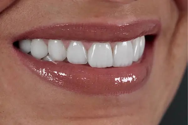 Aksu Clinic Dental Art - Resim 5