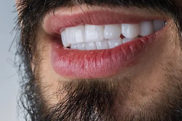 Aksu Clinic Dental Art - Resim 8
