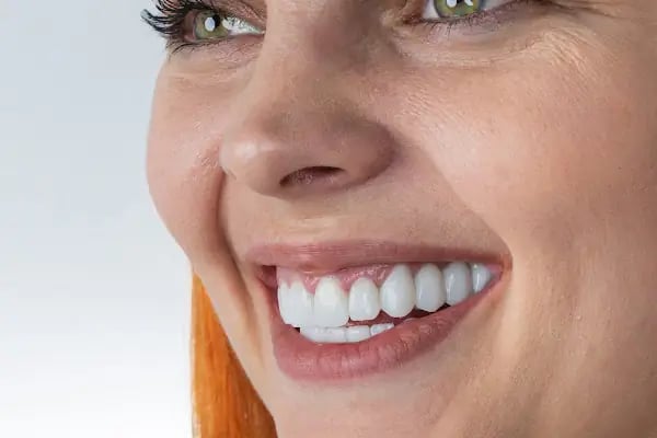 Aksu Clinic Dental Art - Resim 2