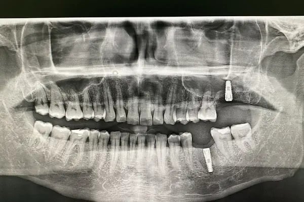 Aksu Clinic Dental Art - Resim 13