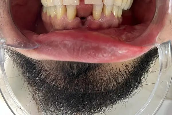 Özel Dent 35 Ağız ve Diş Sağlığı Polikliniği Alsancak - Resim 6