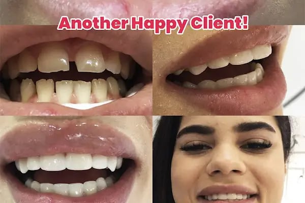 Turkey Dental Experts - Resim 14
