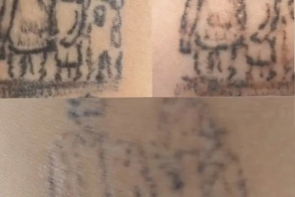 Gökçen Mutlu Kişisel Bakım ve Güzellik Merkezi - Resim 5