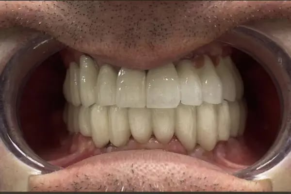 Klinik Esse Ağız ve Diş Sağlığı Polikliniği - Panayır - Resim 10