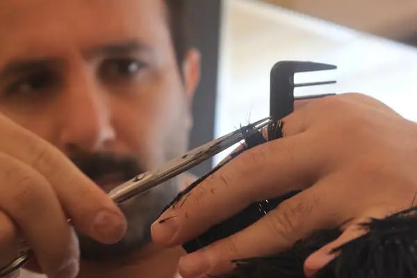 serkan cengiz protez saç merkezi adana - Resim 6