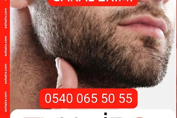 ExHairs - Samsun Saç Ekimi - Bafra Saç Ekimi - Resim 5