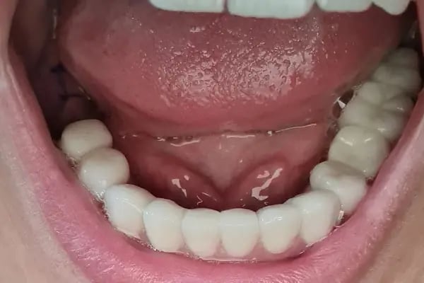 ÖZEL WESTDENT AĞIZ DİŞ HASTANESİ- Türkiye İzmir İmplant Diş Dent Clinic Türkey Dental İmplants in Turkey Zirconium in Turkey - Resim 7